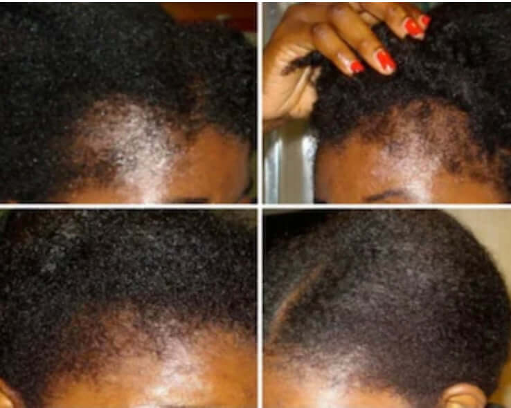 natural hair oil